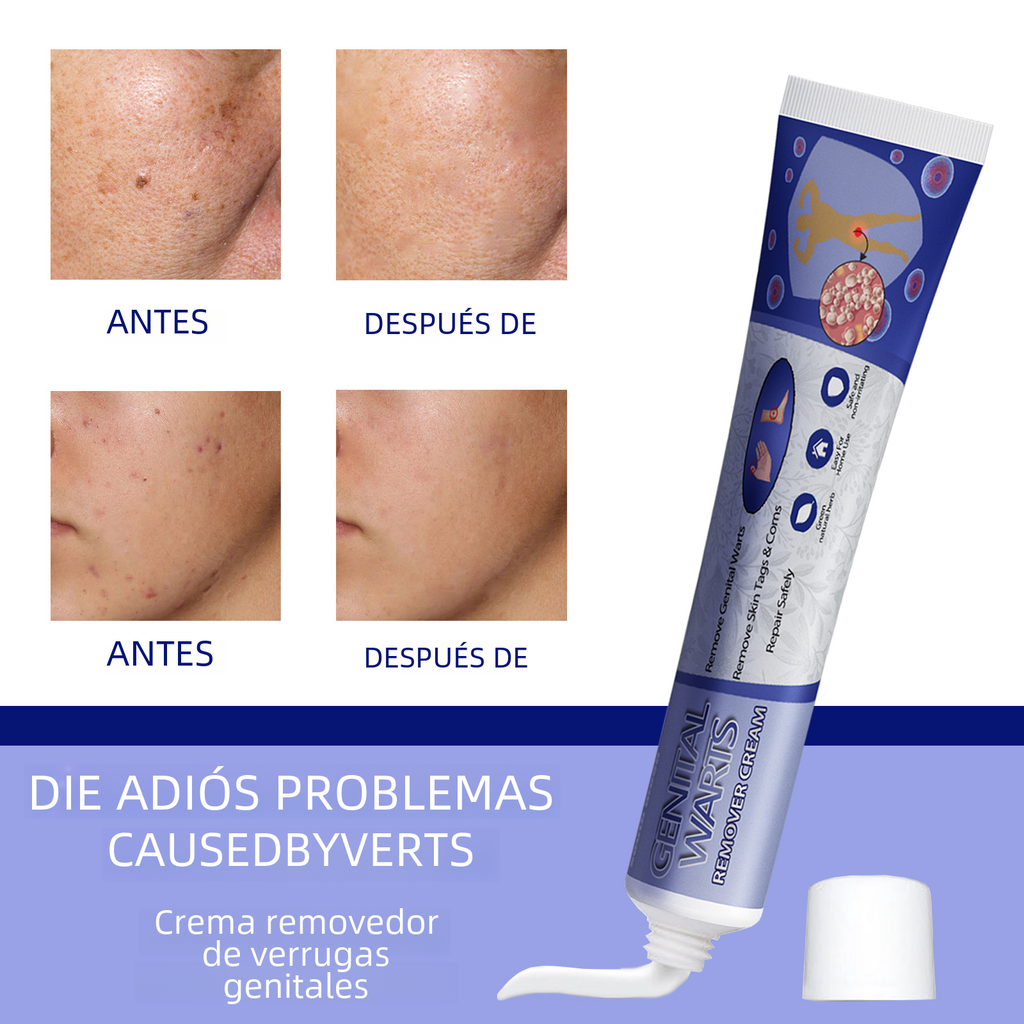 Crème South Moon Anti-Verrues & Réparatrice Peau - Keru Cream 20g