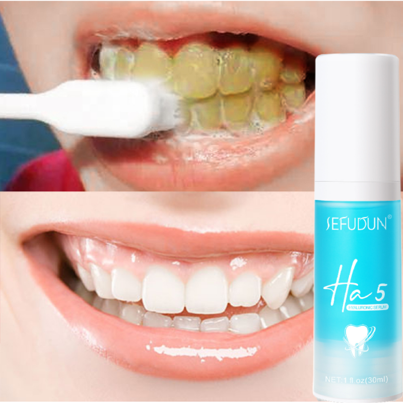 "Anti-Allergic Toothpaste for Fresh Breath and Enamel Care"