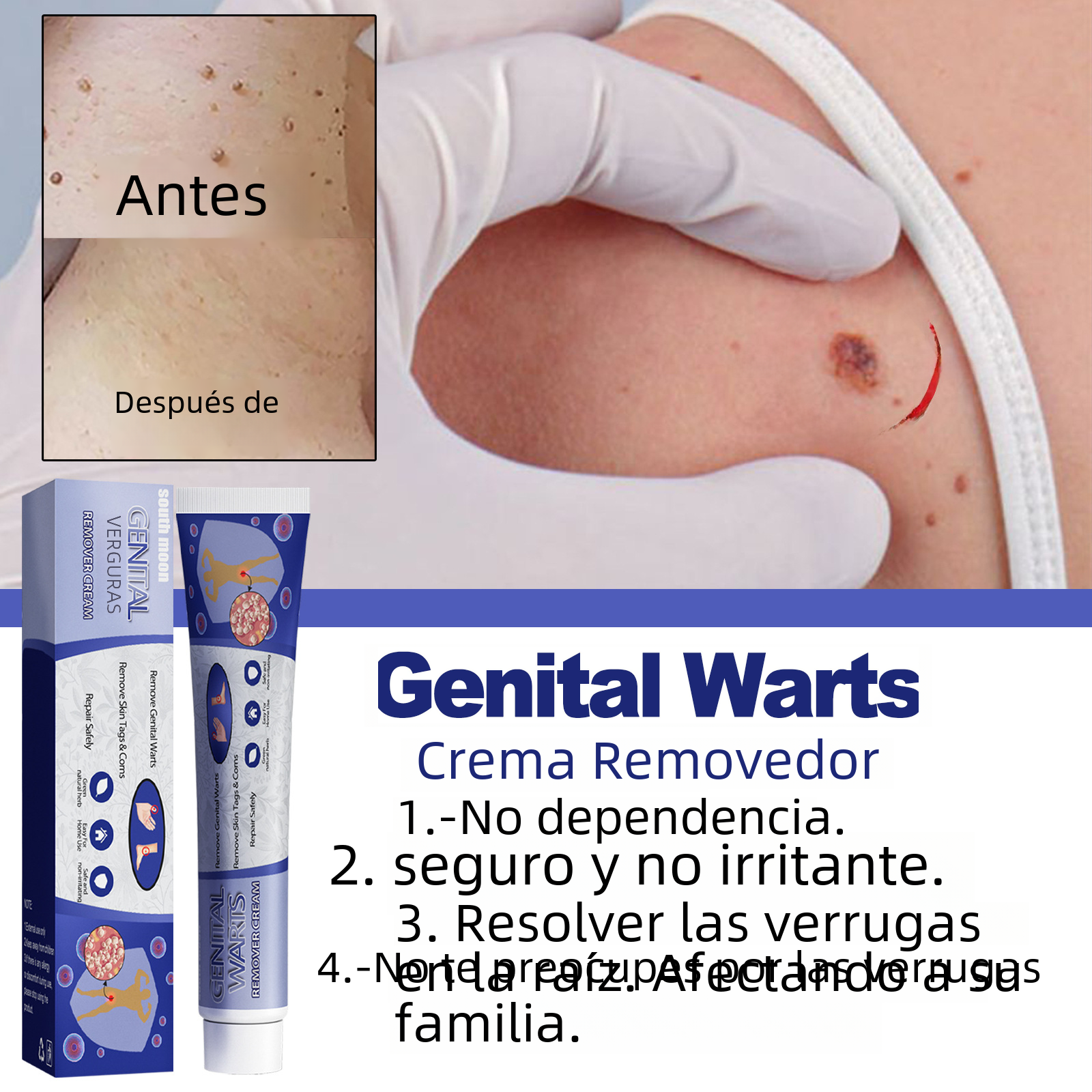 Crème South Moon Anti-Verrues & Réparatrice Peau - Keru Cream 20g