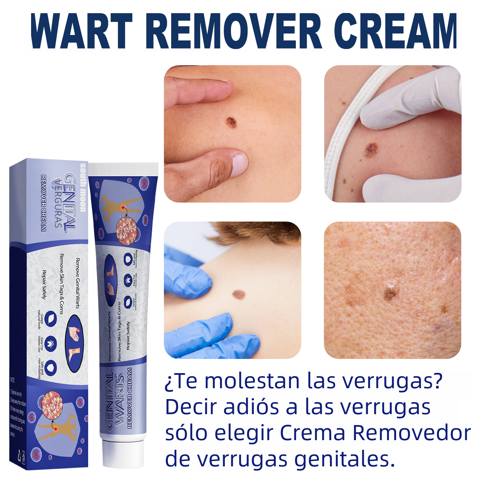 Crème South Moon Anti-Verrues & Réparatrice Peau - Keru Cream 20g