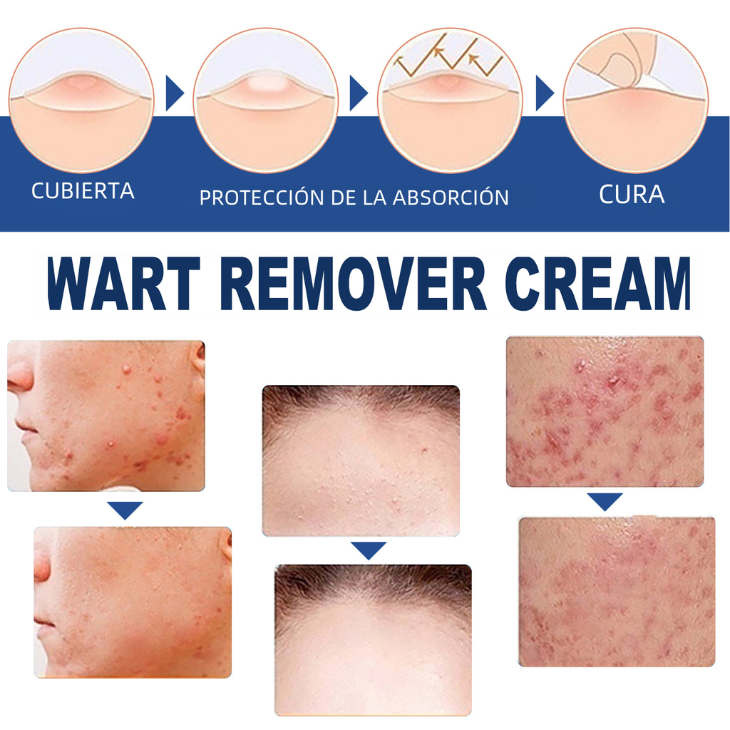Crème South Moon Anti-Verrues & Réparatrice Peau - Keru Cream 20g