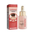 EELHOE Essence Nourrissante du Cuir Chevelu - Soin Capillaire 30ml