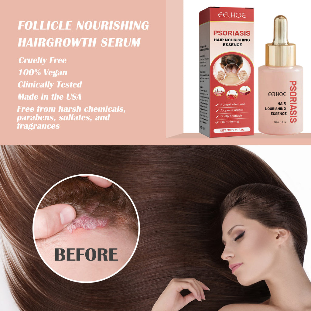 EELHOE Essence Nourrissante du Cuir Chevelu - Soin Capillaire 30ml