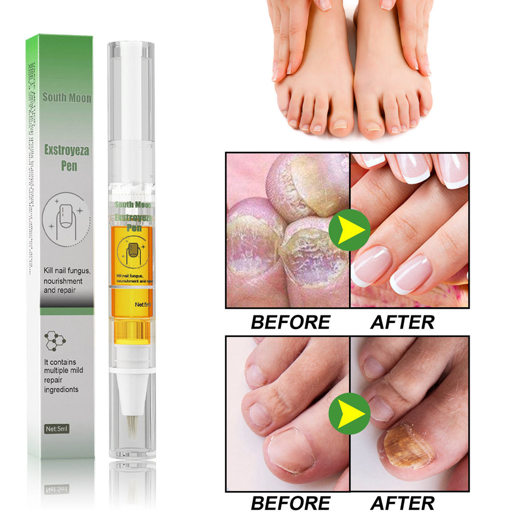 South Moon Liquide Réparateur Ongles - Soin Mycose & Ongles Abîmés 5ml